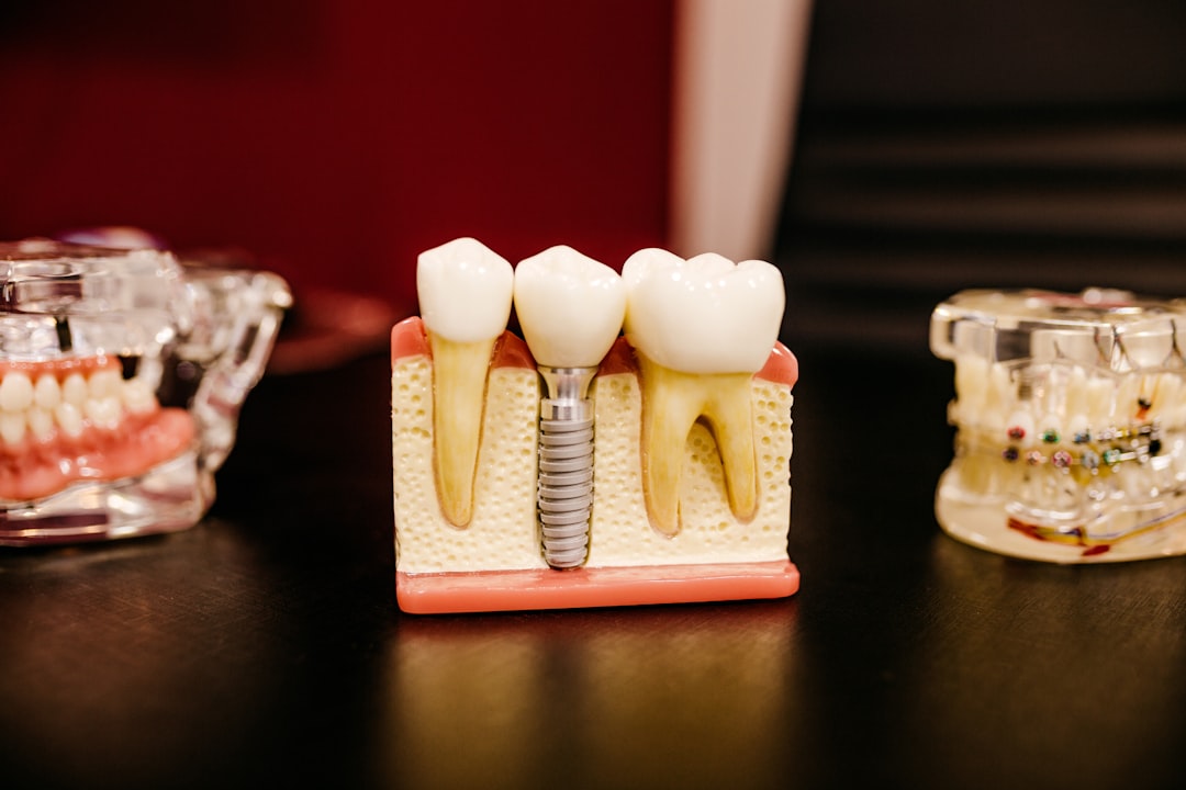 Vaping and Teeth Health: Tips to Keep Your Smile Bright